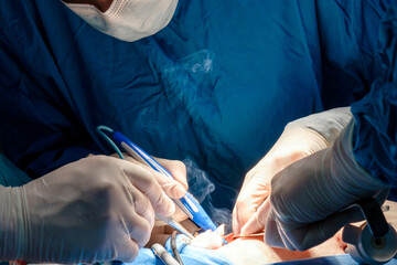 The surgeon holds the electrical coagulator during the minimally invasive operation. Close-up of hands in sterile gloves stained with blood. Blue uniform and medical masks. Smoke from burnt flesh.