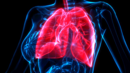 medical 3d illustration, lungs problems on x ray view