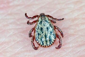 Lyme disease-carrier Ixodes tick Dermacentor marginatus on human skin.
