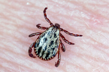 Lyme disease-carrier Ixodes tick Dermacentor marginatus on human skin.
