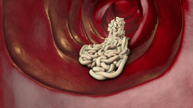 Parasitic worms in the lumen of the lumen, 3D animation. Growth and multiplication of nematode worms invading human intestine