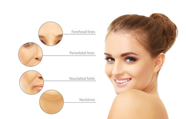 Plastic Surgery Results.Frown/scowl lines ,Nasolabial folds,Neck ,Under eye circles,neck lines.