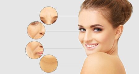 Plastic Surgery Results.Frown/scowl lines ,Nasolabial folds,Neck ,Under eye circles,neck lines.