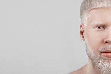 Half face portrait of albino guy with pale skin and white hair over light grey background, free space