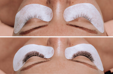 Tretment of Eyelash Extension - before and after