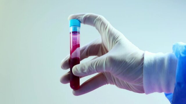 Blood test full tubes in doctor's hand with glove, on the white background, studio shoot.