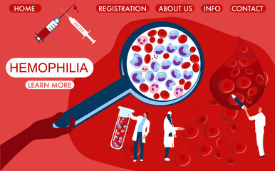 World Hemophilia Day concept. Magnifier with cancer blood full of leukocytes.Tiny doctors make laboratory tests.Website template with Erythrocytes Leukosis disease awareness page. 