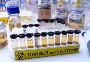  Investigation of sars-cov-2 virus in humans in a wastewater laboratory, conceptual image