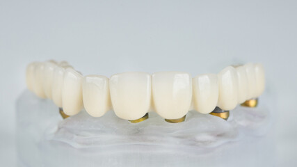 Fototapeta na wymiar temporary dental prosthesis on a white background