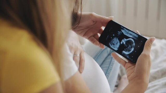 Happiness of motherhood, two women looking at ultrasound image of future baby on smartphone. Homosexual pregnant lesbian couple. IVF maternity, LGBT Pride Month, relationship, childbirth, concept.