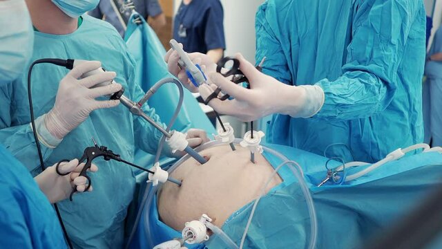A surgeon in latex gloves and a blue uniform holds special medical instruments during a laparoscopic minimally invasive operation. Treatment of proctological diseases.