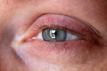 Miserable teary eye looking out the window. Stuck at home sadness in the eye of a woman