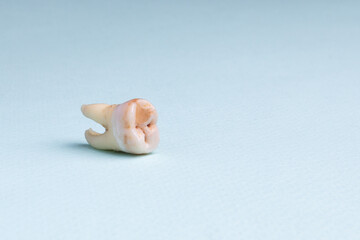 Pulled out wisdom tooth with filling and caries on blue background. Close up of bad wisdom tooth