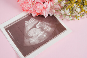 ultrasound scan and flowers on pink background pregnancy and motherhood concept, conscious parenthood