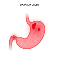 Stomach logo concept