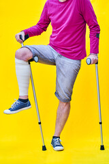 unrecognizable man with one leg bandaged and leaning on a crutch, on a yellow background.