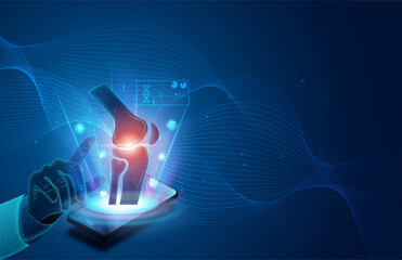 Technology for treatment of knee bone. Abstract traumatology and orthopedics. Medical science in the hospital for body joints.