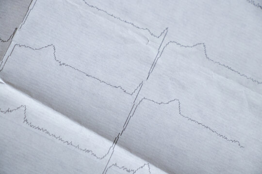 cardiogram on paper as background macro photo