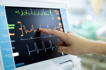 EKG monitor in intra aortic balloon pump machine. Medical equipment in hospital. Medical Technology 	 - obrazy, fototapety, plakaty