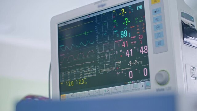 surgical anesthesia machine in operating room shows indicators of life and pulse