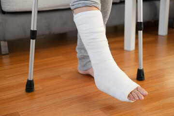 Female legs in gypsum plaster on elbow crutches at home. Fracture of the leg or foot. Concept of...