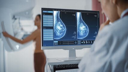 Computer Screen in Hospital Radiology Room: Beautiful Multiethnic Adult Woman Standing Topless Undergoing Mammography Screening Procedure. Screen Showing the Mammogram Scans of Dense Breast Tissues. - Powered by Adobe