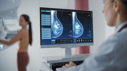 Computer Screen in Hospital Radiology Room: Beautiful Multiethnic Adult Woman Standing Topless Undergoing Mammography Screening Procedure. Screen Showing the Mammogram Scans of Dense Breast Tissues. - obrazy, fototapety, plakaty