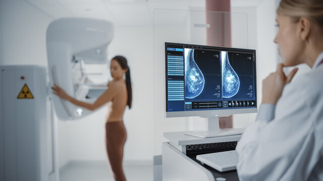 Computer Screen in Hospital Radiology Room: Beautiful Multiethnic Adult Woman Standing Topless Undergoing Mammography Screening Procedure. Screen Showing the Mammogram Scans of Dense Breast Tissues.