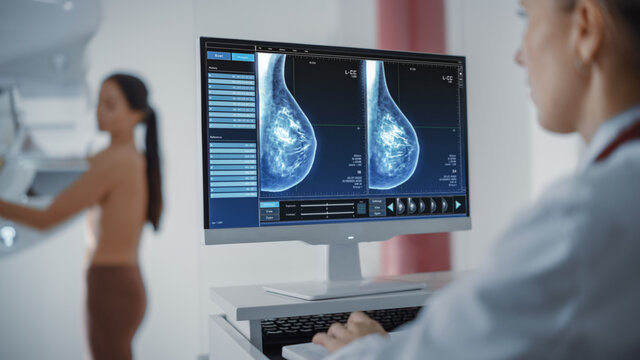 Computer Screen In Hospital Radiology Room: Beautiful Multiethnic Adult Woman Standing Topless Undergoing Mammography Screening Procedure. Screen Showing The Mammogram Scans Of Dense Breast Tissues.