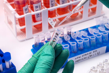 Laboratory research new strain of British sars-cov-2 scientifically named VOC 202012/01 (B.1.1.7), conceptual picture