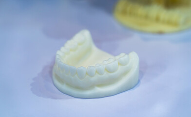 3d printer from a photopolymer material.