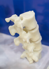 3d printed human spine in 3d printer.