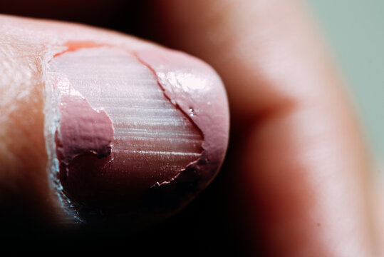 Closeup Shot Of Cracked Nail Polish On A Blurred Background