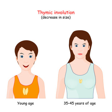Thymic involution. decrease size of the thymus with age.