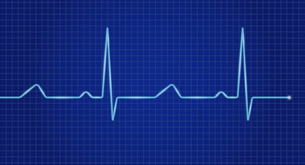 Cardiogram cardiograph oscilloscope blue screen. Heartbeat line. Vector illustration