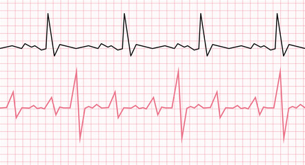 Naklejka premium Cardiogram on a graph paper. Heartbeat line. Vector illustration