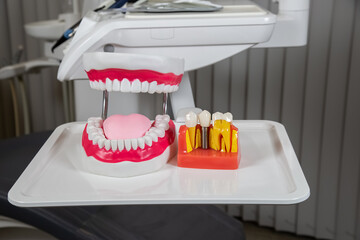 Plastic dental crowns, imitation of a dental prosthesis of a dental bridge