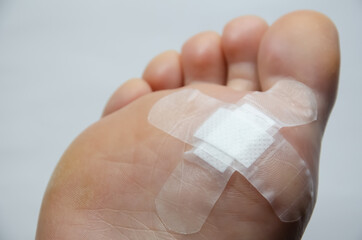 Close up foot with plaster after surgery to remove verruca. Injury feet. White patch protects the...