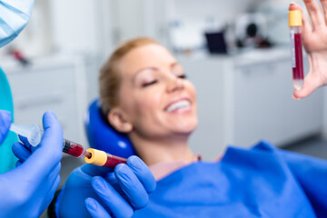 Platelet rich plasma ( PRP) therapy process.