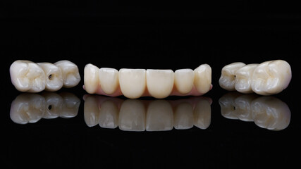 composition of a dental prosthesis made of zirconium for the upper jaw on black glass with reflection © Dental Pro Content