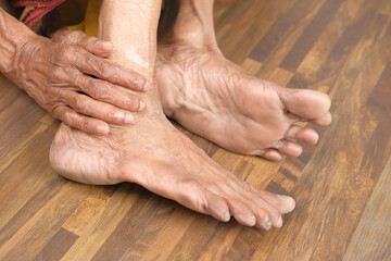 Close up on senior women feet and hand massage on injury spot.