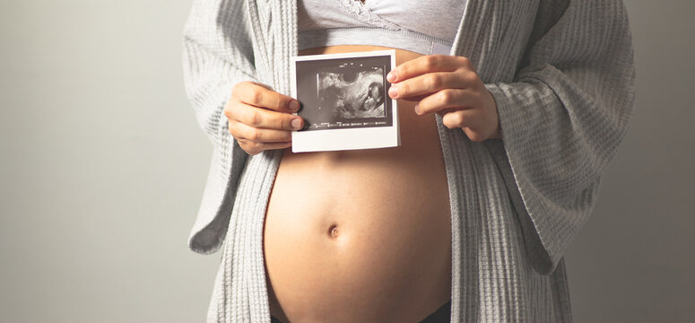 Pregnant woman holding an ultrasound picture next to her pregnant belly. The first photo of the baby. Maternal prenatal care. Maternity, pregnancy, baby expectation concept. Copy space