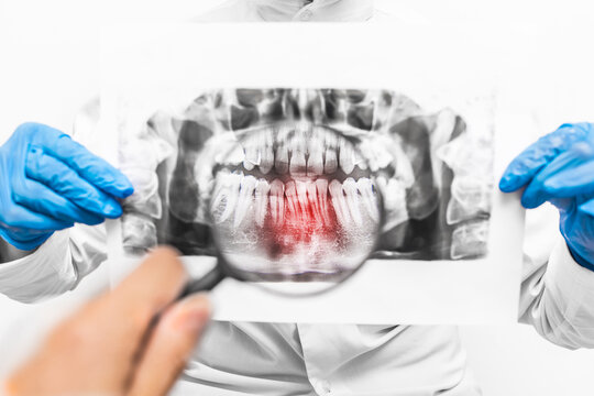 The dentist's hands in blue latex medical gloves hold a x-ray shot of the mouth and examine it using a magnifying glass, close-up