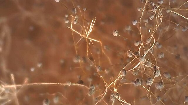 Microscope Mold Sporangium and Sporangiospore 800x Lighitng Biology Fungi