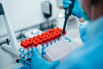 The PCR tester takes a sample analysis from a test tube