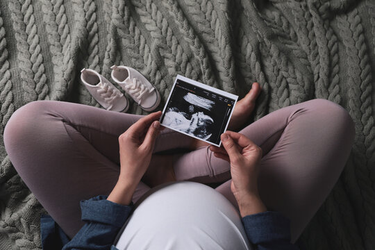 Young pregnant woman with ultrasound picture of baby and shoes on knitted plaid, top view