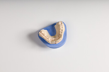 Close up artificial dentition on dental imprint in a dental laboratory on a workbench ready for use