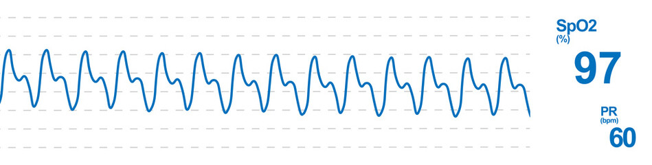 Pulse oximetry monitoring. SpO2 monitor screen. SpO2, PR and plethysmography parameters