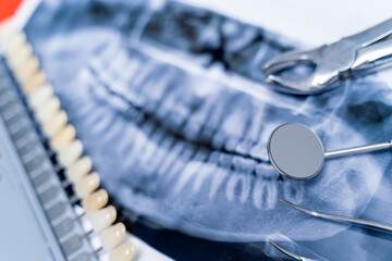 Composition of xray photo and dentist equipment and row of teeth. Close up.