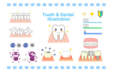 Dental character set implant periodontal disease, etc.
